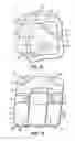 Fig. 07 - Aesthetic orthodontic bracket and method of making same