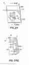 Fig. 13 - Aesthetic orthodontic bracket and method of making same