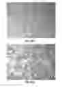 Fig. 16 - Aesthetic orthodontic bracket and method of making same