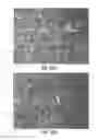 Fig. 18 - Aesthetic orthodontic bracket and method of making same
