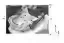 Fig. 01 - Mandibular attachment for correction of malocclusion
