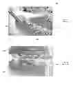 Fig. 04 - Mandibular attachment for correction of malocclusion