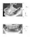 Fig. 05 - Mandibular attachment for correction of malocclusion