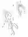 Fig. 10 - Fluoride releasing bite plate