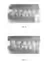 Fig. 02 - MANDIBULAR ATTACHMENT FOR CORRECTION OF MALOCCLUSION
