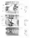 Fig. 03 - MANDIBULAR ATTACHMENT FOR CORRECTION OF MALOCCLUSION