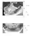Fig. 05 - MANDIBULAR ATTACHMENT FOR CORRECTION OF MALOCCLUSION