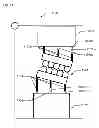 Fig. 17 - Virtual design of attachment of dental model in articulator