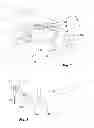 Fig. 02 - Dental cutting system and method with remote cutting guide