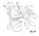 Fig. 09 - Dental cutting system and method with remote cutting guide