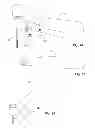 Fig. 14 - Dental cutting system and method with remote cutting guide