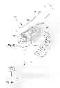 Fig. 15 - Dental cutting system and method with remote cutting guide