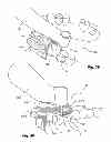 Fig. 16 - Dental cutting system and method with remote cutting guide