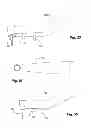Fig. 21 - Dental cutting system and method with remote cutting guide