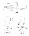 Fig. 22 - Dental cutting system and method with remote cutting guide