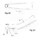 Fig. 24 - Dental cutting system and method with remote cutting guide