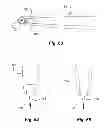 Fig. 25 - Dental cutting system and method with remote cutting guide