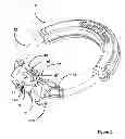 Fig. 02 - Matrix ring for tooth restoration