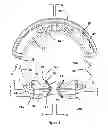 Fig. 03 - Matrix ring for tooth restoration