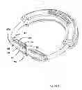 Fig. 04 - Matrix ring for tooth restoration