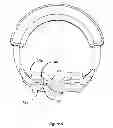 Fig. 05 - Matrix ring for tooth restoration