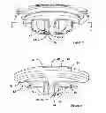 Fig. 08 - Matrix ring for tooth restoration