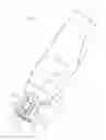 Fig. 02 - Abutment position locator