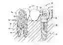 Fig. 01 - DENTAL BRIDGE