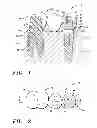 Fig. 02 - DENTAL BRIDGE