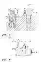 Fig. 04 - DENTAL BRIDGE