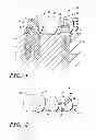 Fig. 02 - Dental bridge