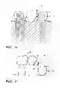 Fig. 04 - Dental bridge