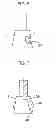 Fig. 03 - Dental prosthesis and method for the production thereof