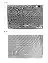 Fig. 04 - Powder for dental powder blasting