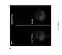 Fig. 16 - Uses of labeled HSP90 inhibitors