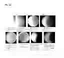 Fig. 22 - METHODS AND APPARATUS FOR TARGET CELL MAGNETIC ENRICHMENT, ISOLATION AND BIOLOGICAL ANALYSIS