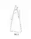 Fig. 03 - Inflatable stand up paddle board with rigid needle nose