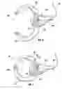 Fig. 04 - Toy apparatus