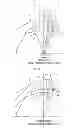 Fig. 07 - Fixed type constant-velocity universal joint