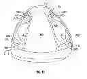 Fig. 10 - Golf club head
