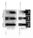 Fig. 03 - BLOOD AND BONE MARROW SIMULANT