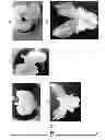Fig. 101 - CULTURE MEDIA FOR STEM CELLS