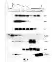 Fig. 05 - METHODS FOR MEASURING HDL SUBPOPULATIONS