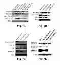 Fig. 30 - MULTIPLEXED KINASE INHIBITOR BEADS AND USES THEREOF