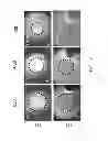 Fig. 10 - DEVICE AND METHOD FOR CELL-EXCLUSION PATTERNING