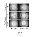 Fig. 11 - DEVICE AND METHOD FOR CELL-EXCLUSION PATTERNING