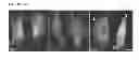 Fig. 13 - Methods and compositions for targeting adipose cells in mammals