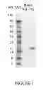 Fig. 02 - METHODS OF TREATMENT FOR RETINAL DISEASES