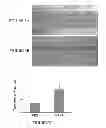 Fig. 04 - METHODS OF TREATMENT FOR RETINAL DISEASES