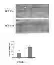 Fig. 05 - METHODS OF TREATMENT FOR RETINAL DISEASES